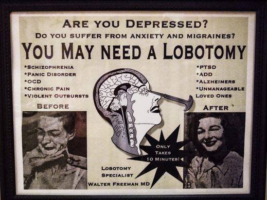 lobotomy.jpg
