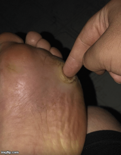 lolfoot.gif