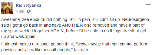 ltfbepiduralies.png