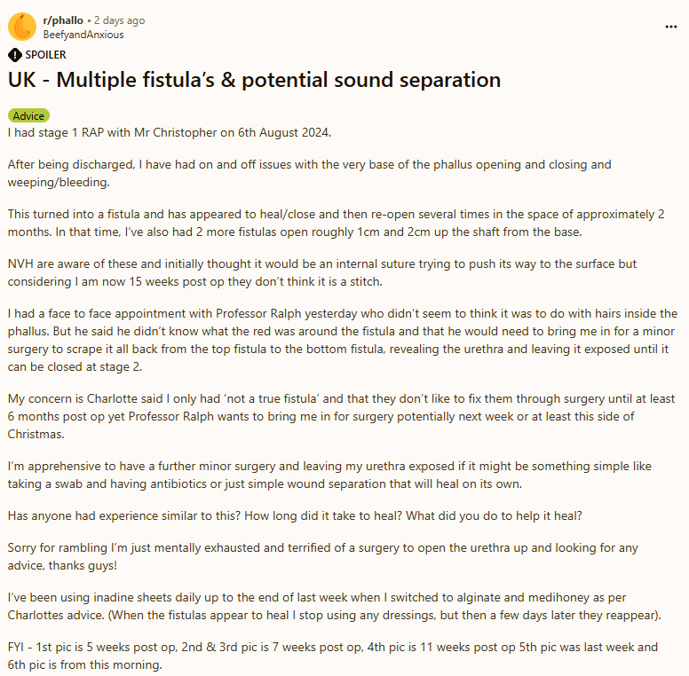 Multiple_fistulas1.jpg