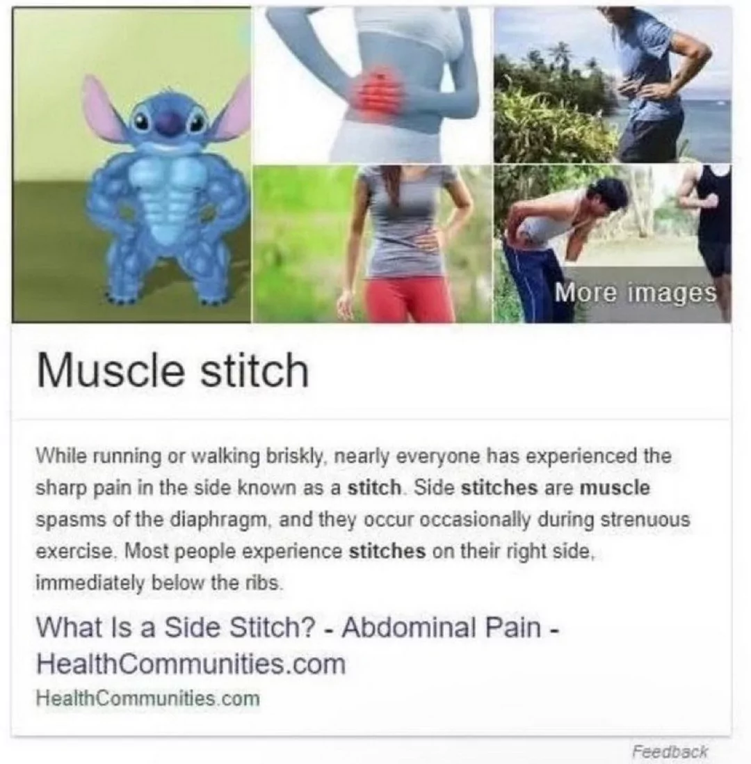 muscle stitch.webp