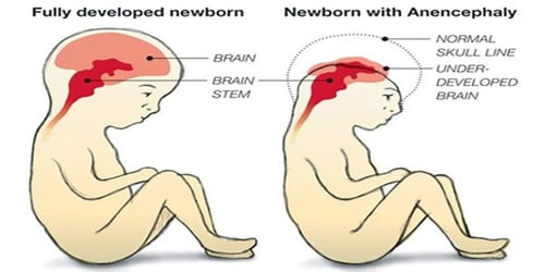 nobrain2.jpg