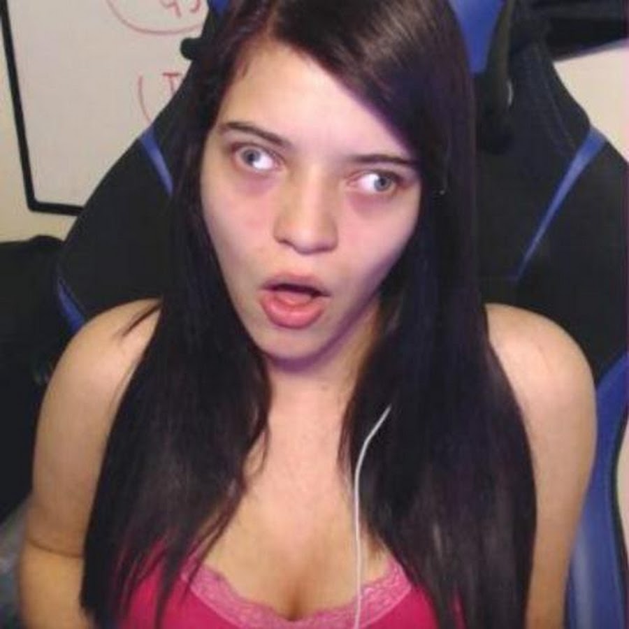 Normal Eyes.jpg