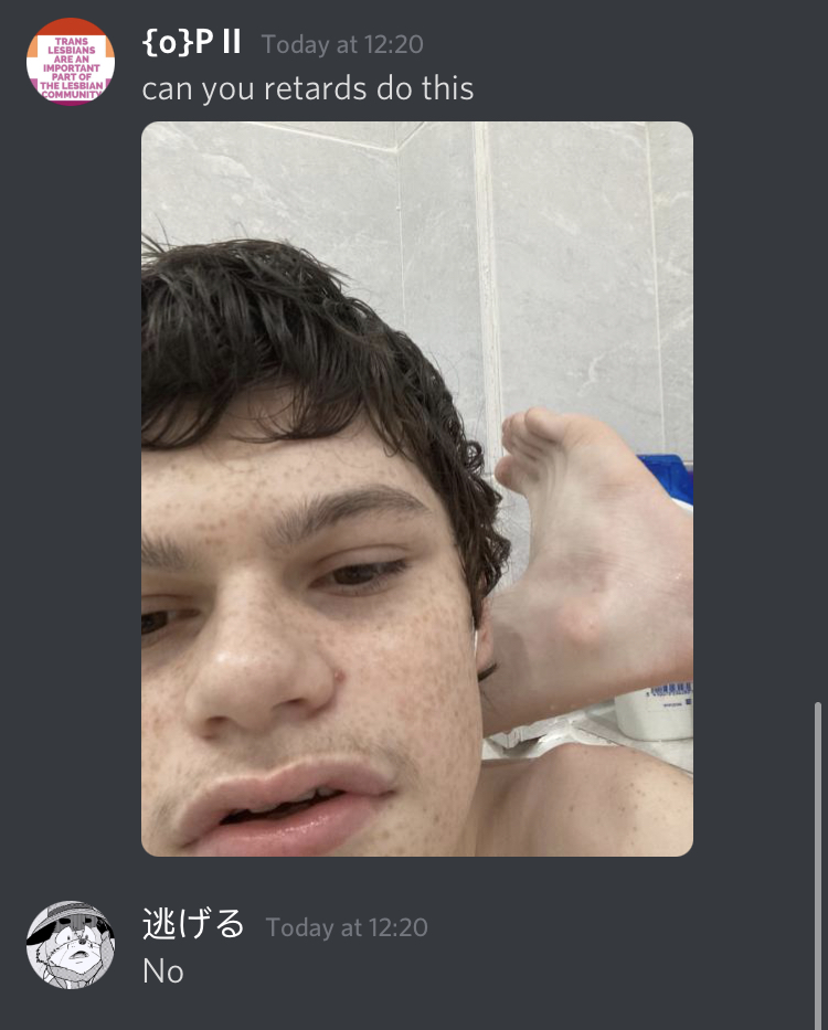 op.jpg