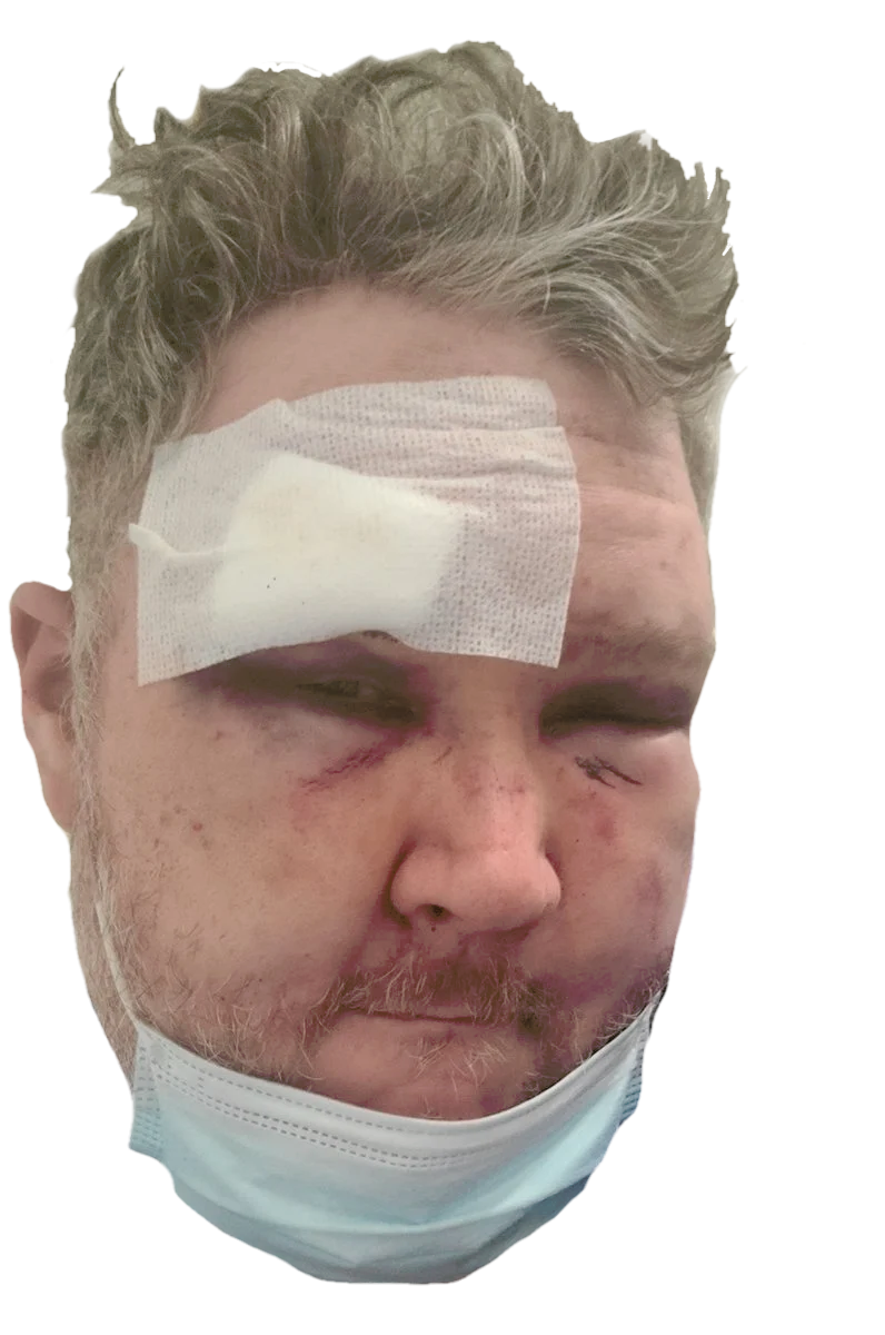 painralph.png