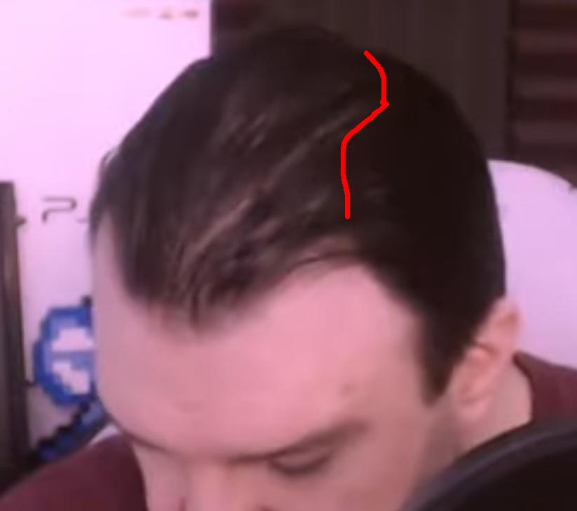 phil bald.jpg