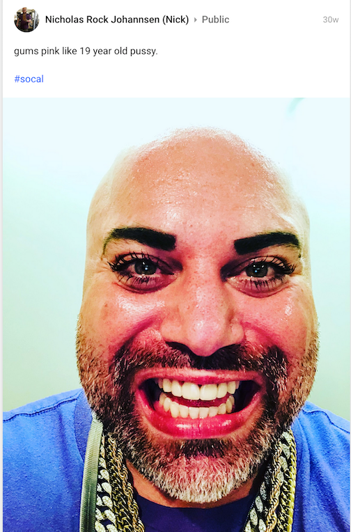 pink gums.png