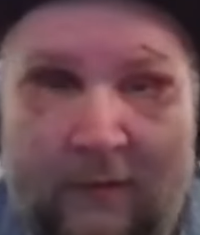ralphfuckedupface.png