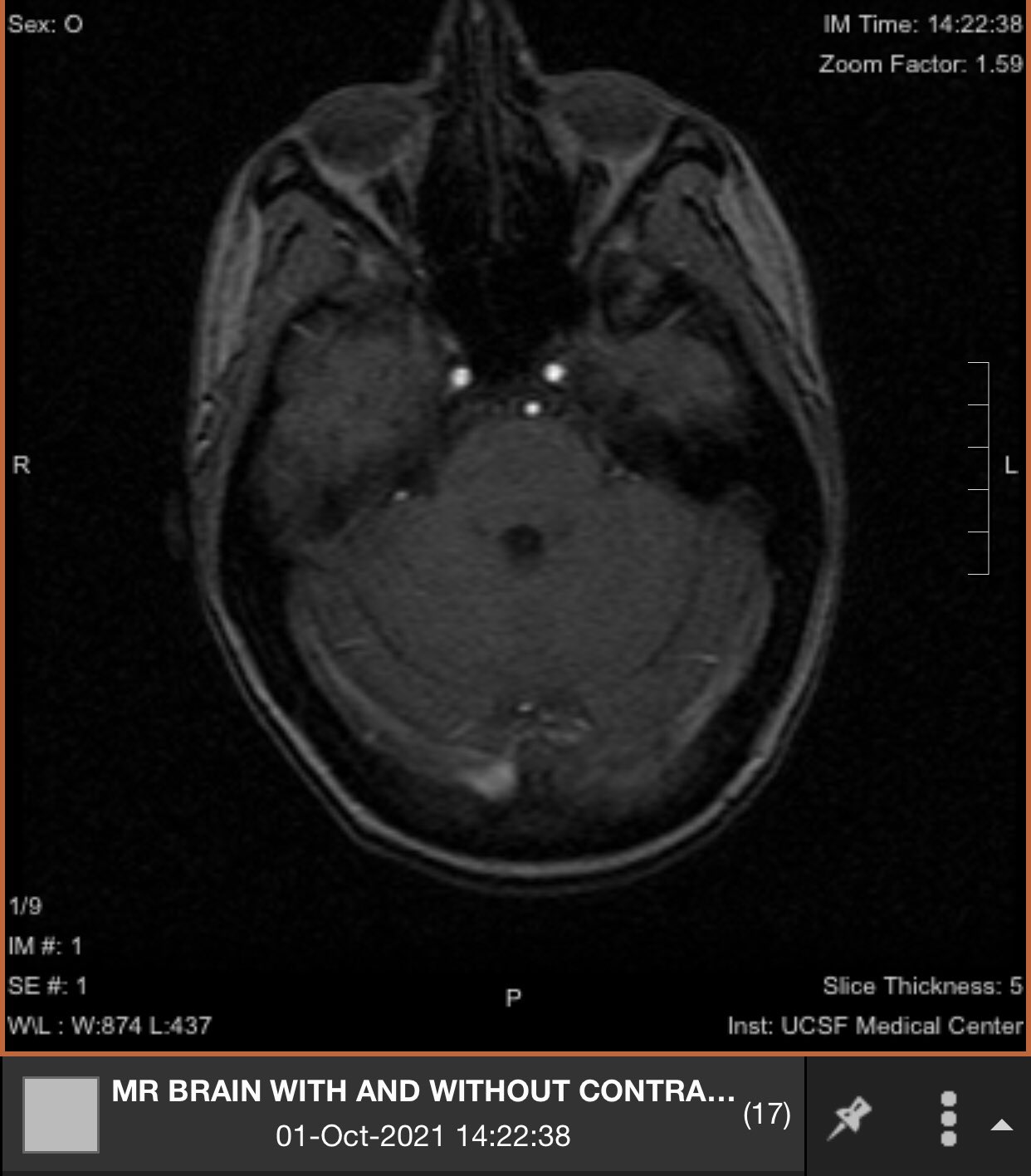 ripley_mri_2.jpeg