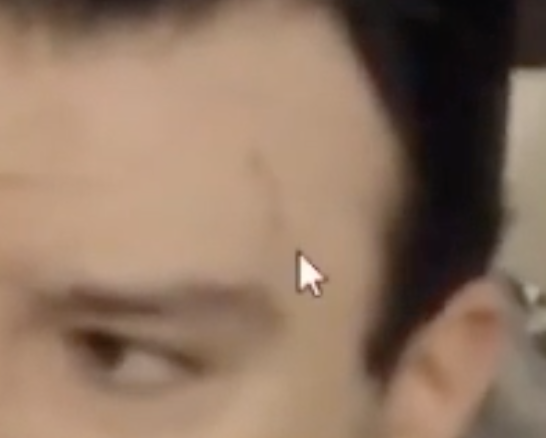 scar2.png