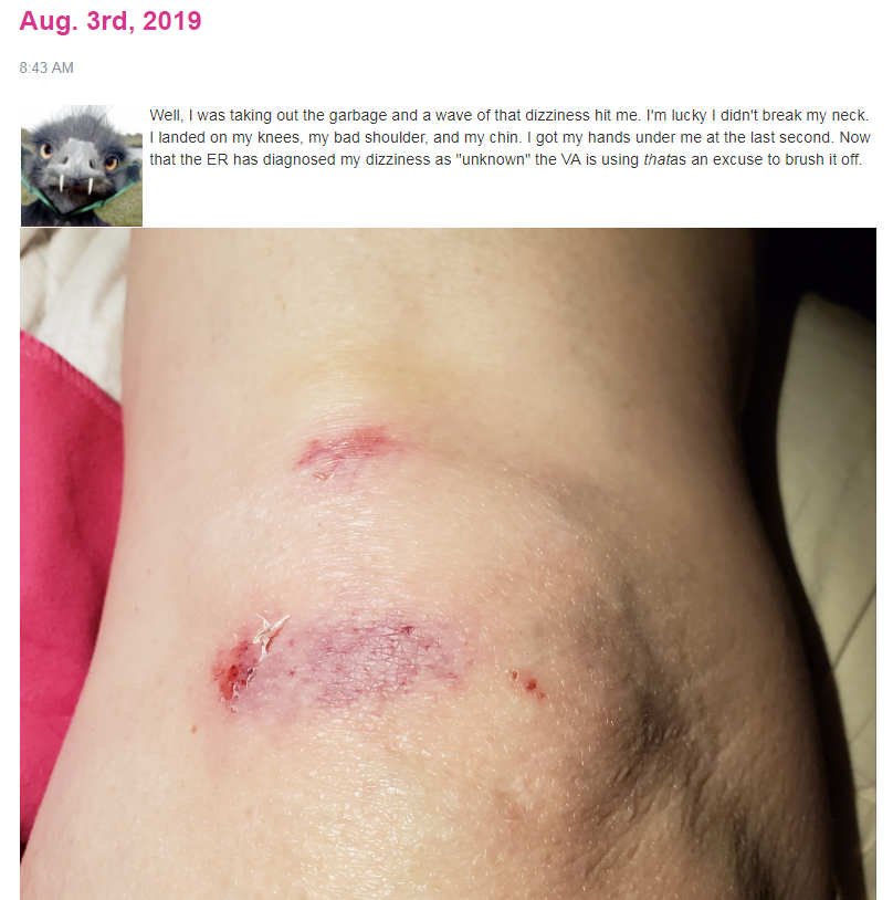 skinned knee.PNG