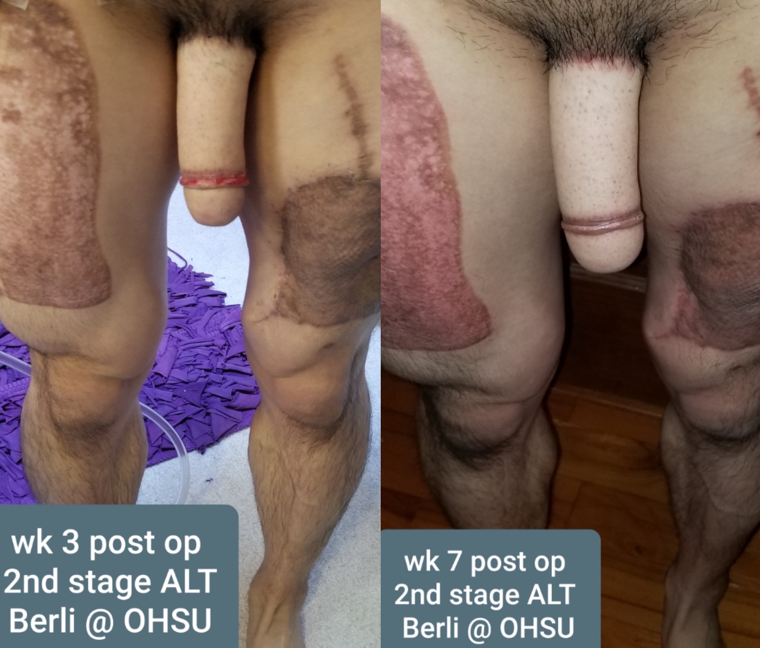 Stage_2_wk_3_vs_7.jpg