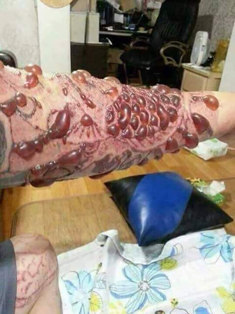 Tattooing gone wrong.jpg