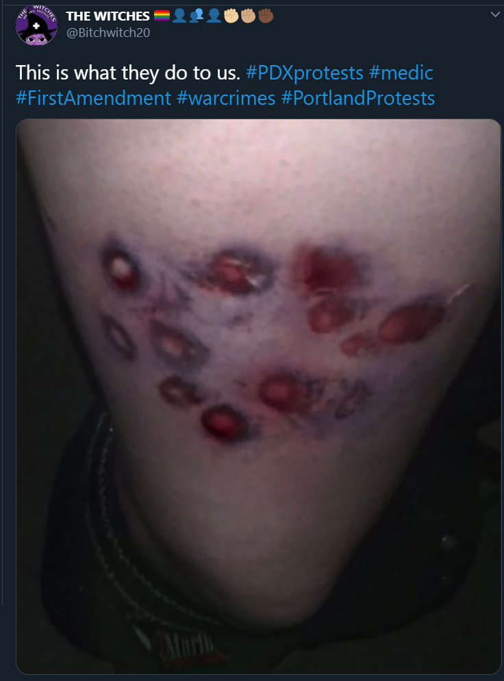 tds.png