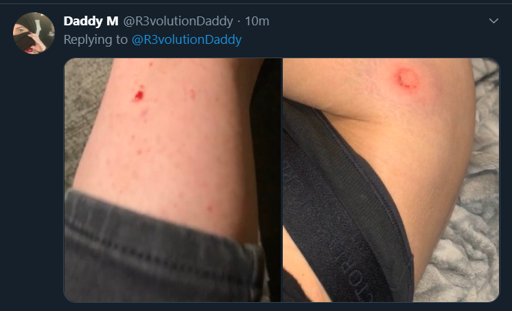 tds.png