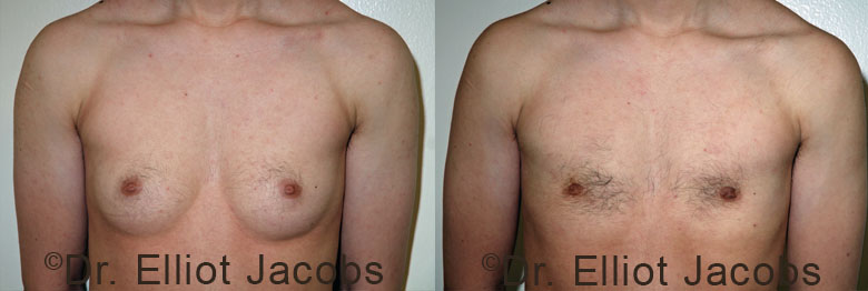 techniques-ftm-ba1-big.jpg