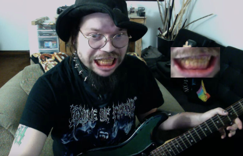 teeth.jpg