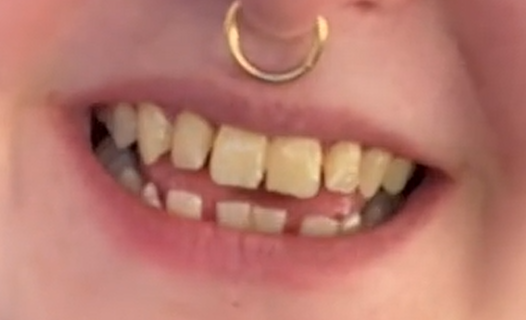 teeth.PNG