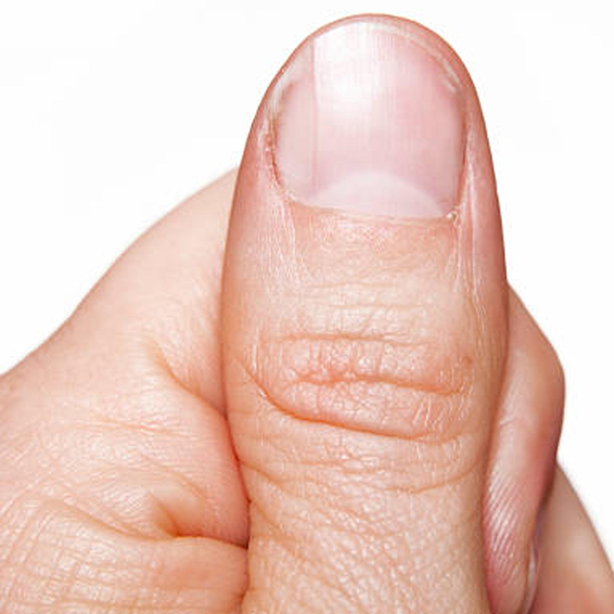 thumb.webp