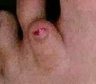 Toe.jpg