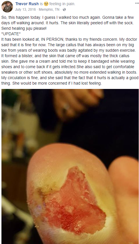 toenail.PNG