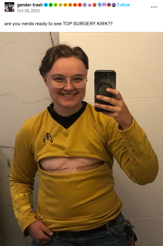 top surgery kirk.png