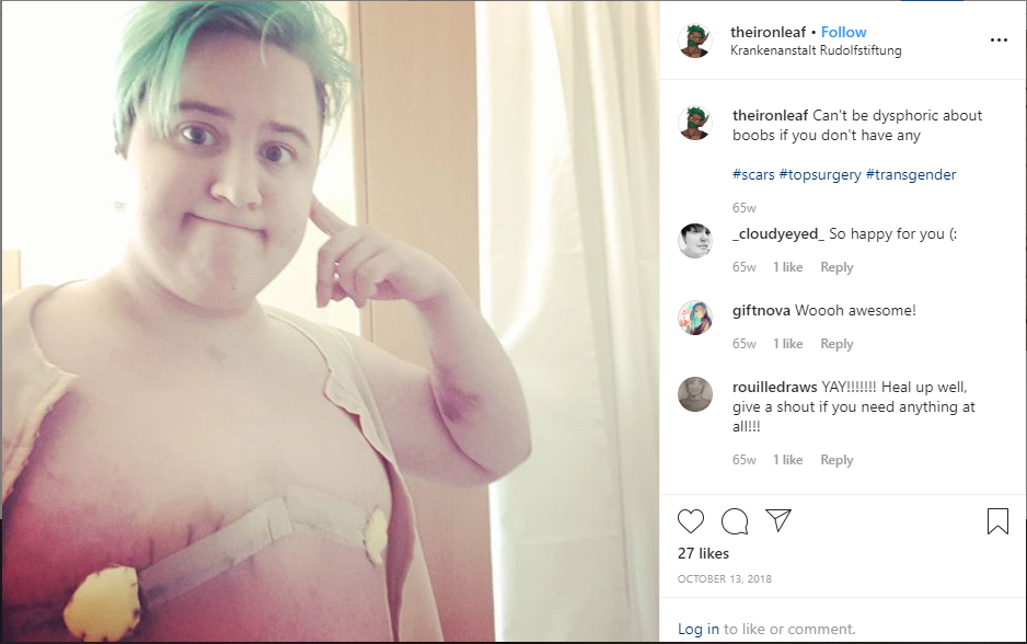 top surgery.PNG