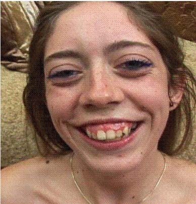 Ultimate skank.jpg
