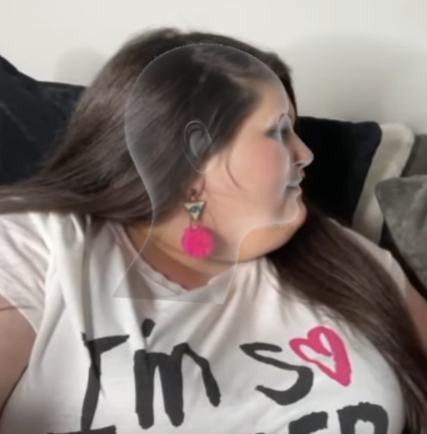 Unfortunate fat.PNG