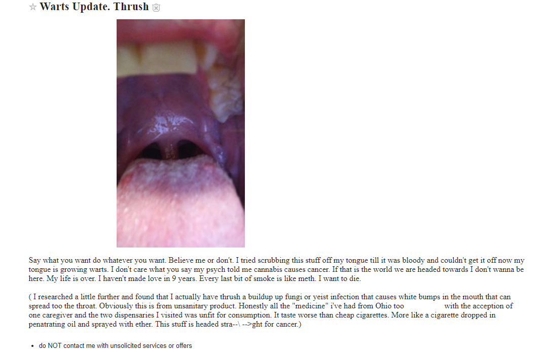 warts.png