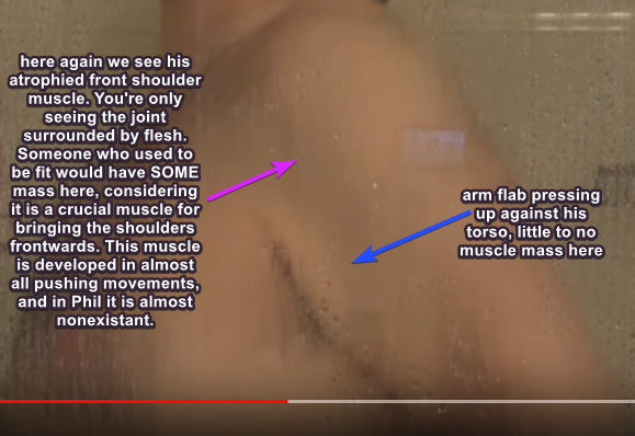XZz1ZxV.png