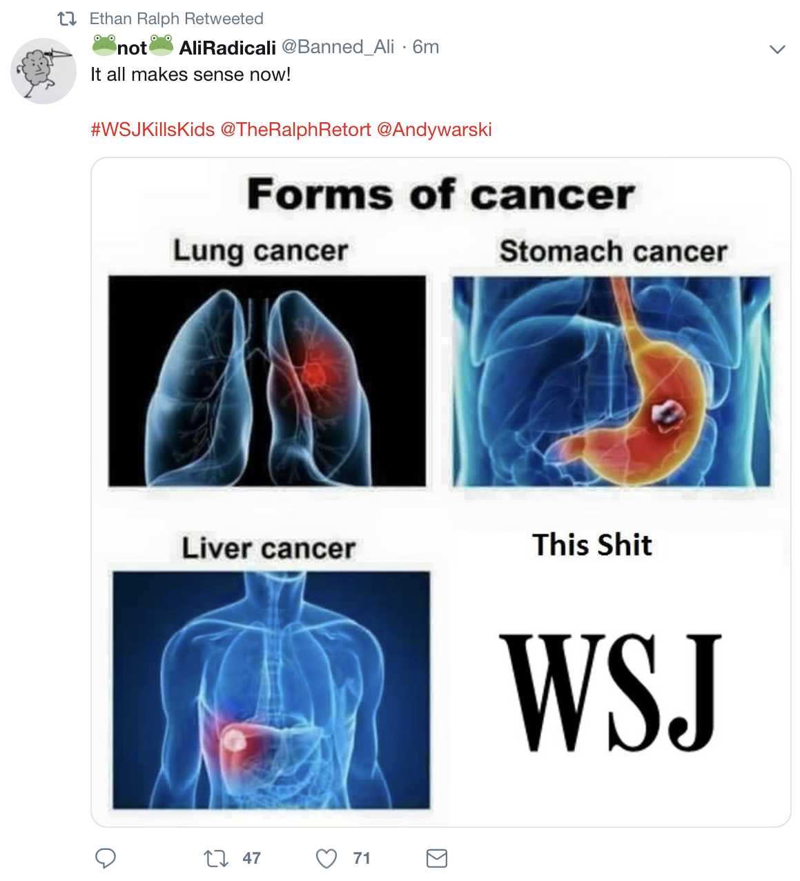 6OsTvxi.png