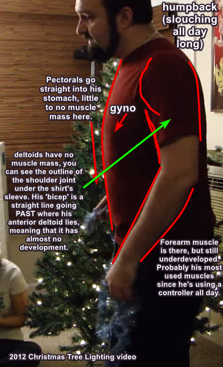 VNqTLTL.png