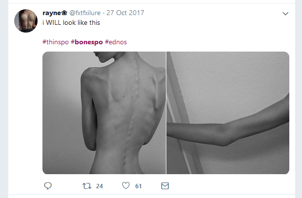 etzpns.PNG